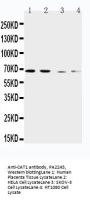 Anti-CAT1/SLC7A1 Antibody Picoband®