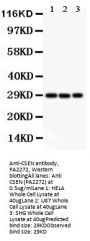 Anti-CSEN/KCNIP3 Antibody Picoband®