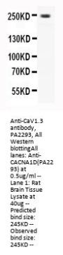 Anti-CaV1.3/CACNA1D Antibody Picoband®