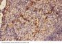 Anti-C5/C5a Antibody Picoband®