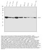 Anti-ACAA2 Antibody Picoband®