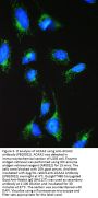 Anti-ACAA2 Antibody Picoband®