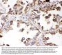 Anti-ALDH7A1 Antibody Picoband®