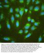 Anti-ALDH7A1 Antibody Picoband®