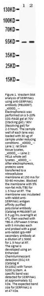 Anti-alpha 1 Antitrypsin/SERPINA1 Antibody Picoband®