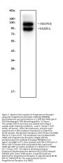 Anti-Progesterone Receptor/PGR Antibody Picoband®