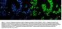 Anti-Progesterone Receptor/PGR Antibody Picoband®