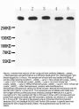 Anti-Ki67/MKI67 Antibody Picoband®
