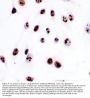 Anti-Ki67/MKI67 Antibody Picoband®