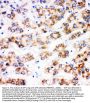 Anti-alpha 1 Fetoprotein/AFP Antibody Picoband®