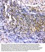 Anti-Csk Antibody Picoband®