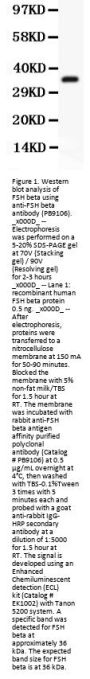 Anti-FSH beta/FSHB Antibody Picoband®