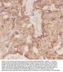 Anti-FSH beta/FSHB Antibody Picoband®