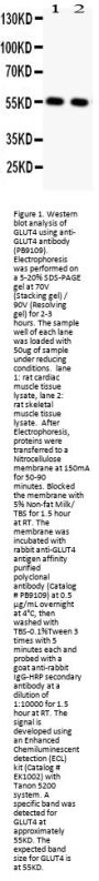 Anti-Glucose Transporter GLUT4/SLC2A4 Antibody Picoband®