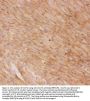 Anti-Glucose Transporter GLUT4/SLC2A4 Antibody Picoband®