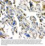 Anti-Angiotensin Converting Enzyme 1/ACE Antibody Picoband®