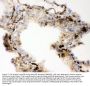 Anti-Angiotensin Converting Enzyme 1/ACE Antibody Picoband®
