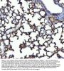 Anti-Angiotensin Converting Enzyme 1/ACE Antibody Picoband®