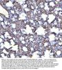 Anti-Angiotensin Converting Enzyme 1/ACE Antibody Picoband®