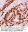 Anti-ATF2 Antibody Picoband®