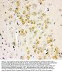 Anti-Ionotropic Glutamate receptor 2/GRIA2 Antibody Picoband®