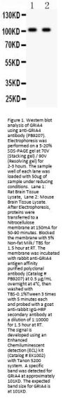 Anti-Ionotropic Glutamate receptor 4/GRIA4 Antibody Picoband®