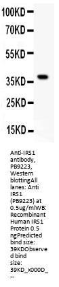 Anti-IRS1 Antibody Picoband®
