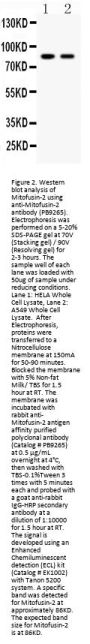Anti-Mitofusin 2/MFN2 Antibody Picoband®