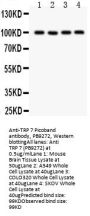 Anti-TRP 7/TRPC7 Antibody Picoband®