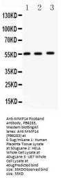 Anti-MMP14 Antibody Picoband®
