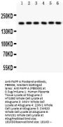 Anti-PAPP A/PAPPA Antibody Picoband®
