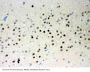Anti-Parkin/PRKN Antibody Picoband®