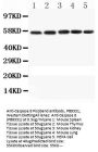 Anti-Caspase-8/CASP8 Antibody Picoband®