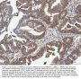 Anti-PP2A-alpha/PPP2CA Antibody Picoband®