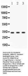 Anti-Cyclin D1/CCND1 Antibody Picoband®