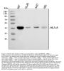 Anti-HLA A/HLA-A Antibody Picoband®