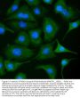 Anti-PKM2 Antibody Picoband®
