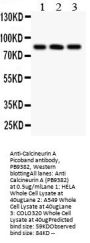 Anti-Calcineurin A/PPP3CA Antibody Picoband®