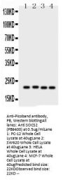 Anti-SOCS2 Antibody Picoband®