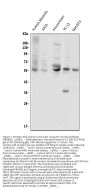 Anti-Glucose Transporter GLUT1/SLC2A1 Antibody Picoband®