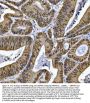 Anti-SNRPN Antibody Picoband®