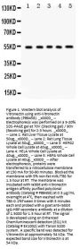 Anti-Vitronectin/VTN Antibody Picoband®