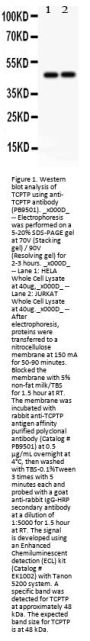 Anti-TCPTP/PTPN2 Antibody Picoband®