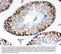 Anti-CDK1 Antibody Picoband®