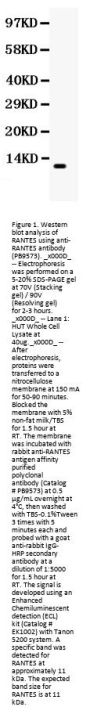 Anti-RANTES/CCL5 Antibody Picoband®