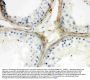 Anti-Apolipoprotein J/CLU Antibody Picoband®