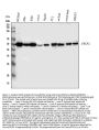 Anti-Fascin/FSCN1 Antibody Picoband®