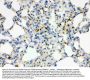 Anti-CD41/Integrin alpha 2b/ITGA2B Antibody Picoband®