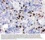 Anti-S100A9 Antibody Picoband®