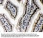 Anti-Caseine Kinase 1 alpha/CSNK1A1 Antibody Picoband®